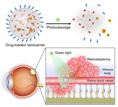 The research team developed a green light-responsive nanocarrier based on the self-assembly of photocleavable three-legged molecules. After intravenous injection of drug-loaded nanocarriers, the light-triggered drug release in retinoblastoma exhibited significant anticancer efficacy and minimal side effects.
 